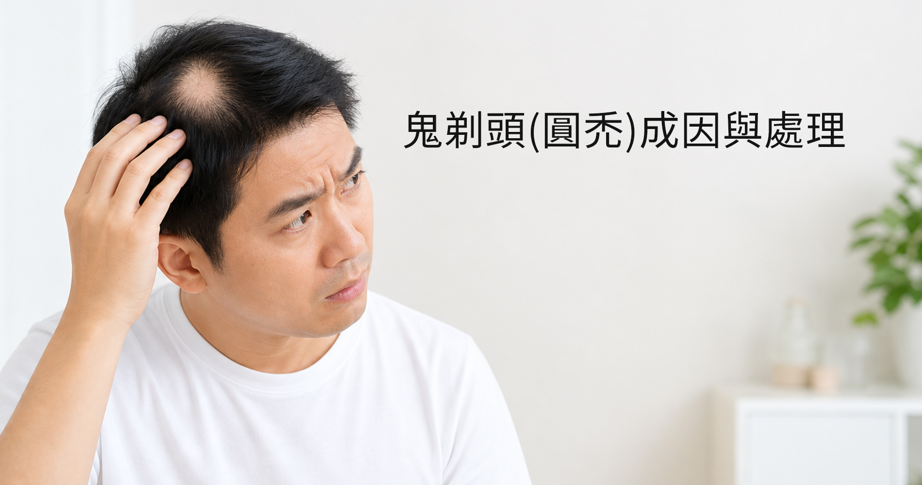 鬼剃頭(圓禿)成因與處理