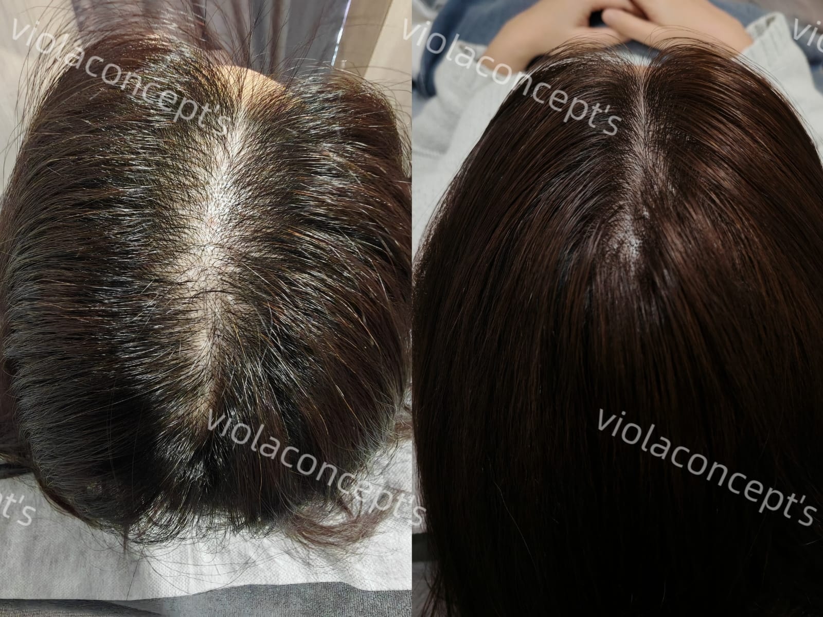 專業頭皮護理服務